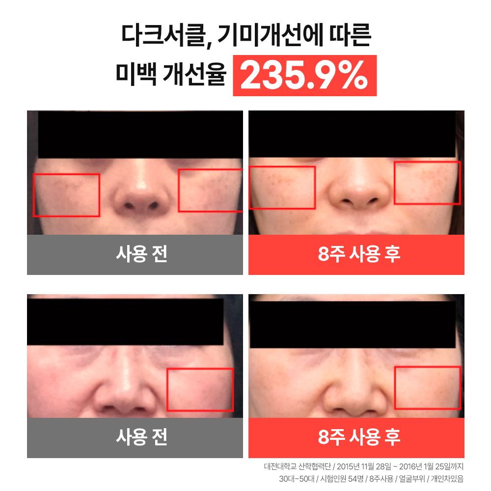 Mimi FGF MTS Active Ampolla Melasma