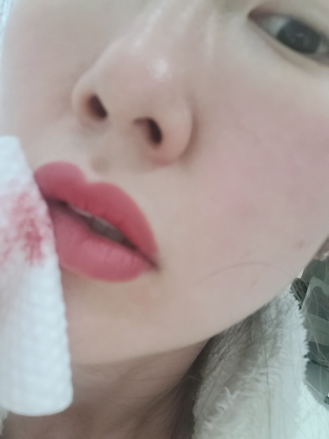 착색