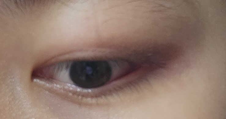 눈 발색
