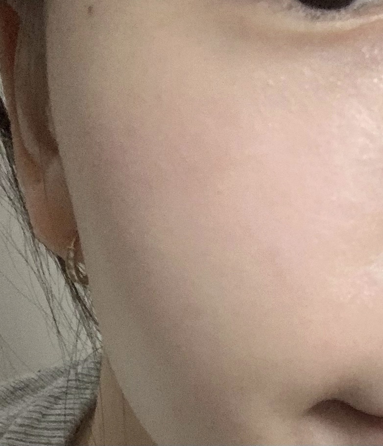 볼 발색