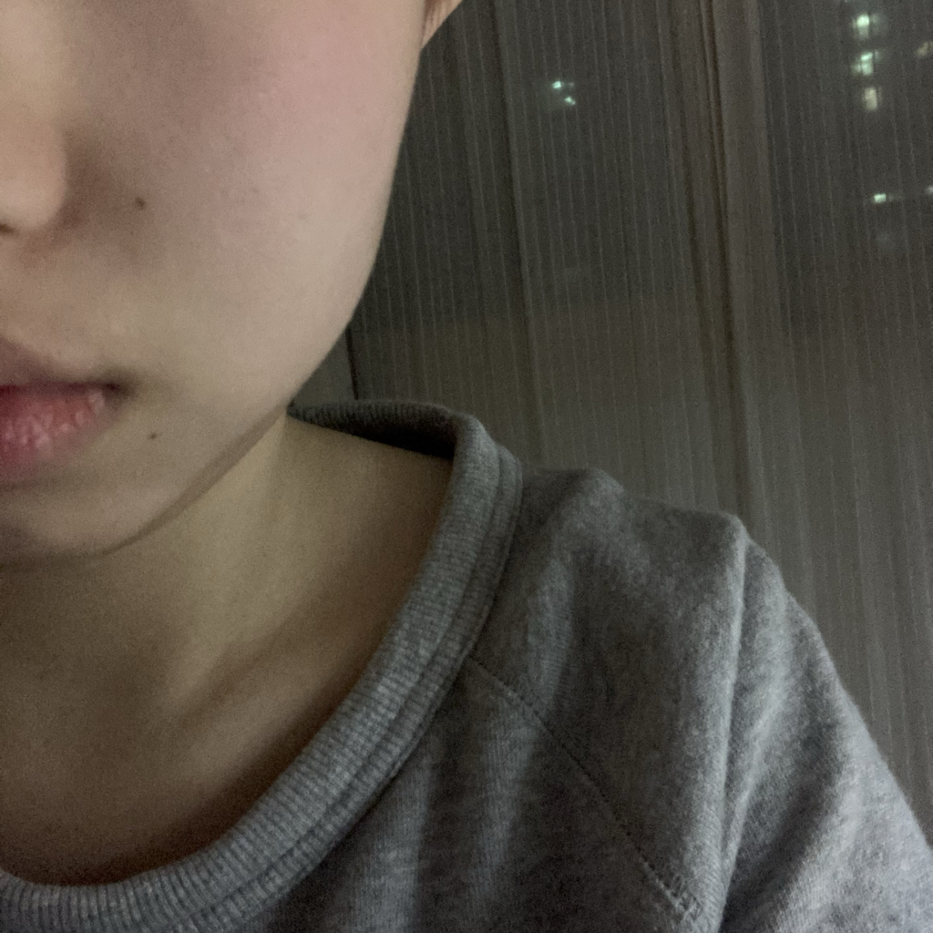 볼 발색