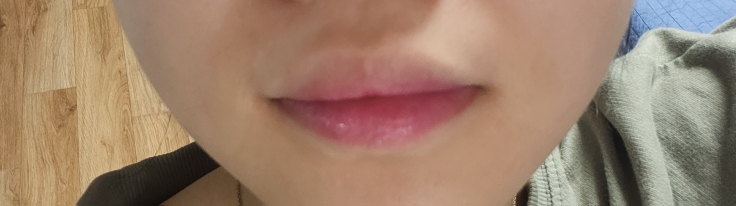 입술 발색