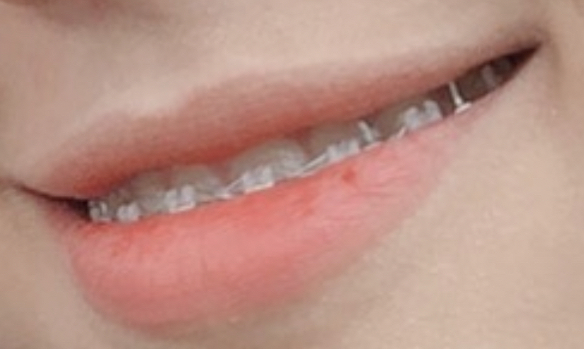 입술 발색