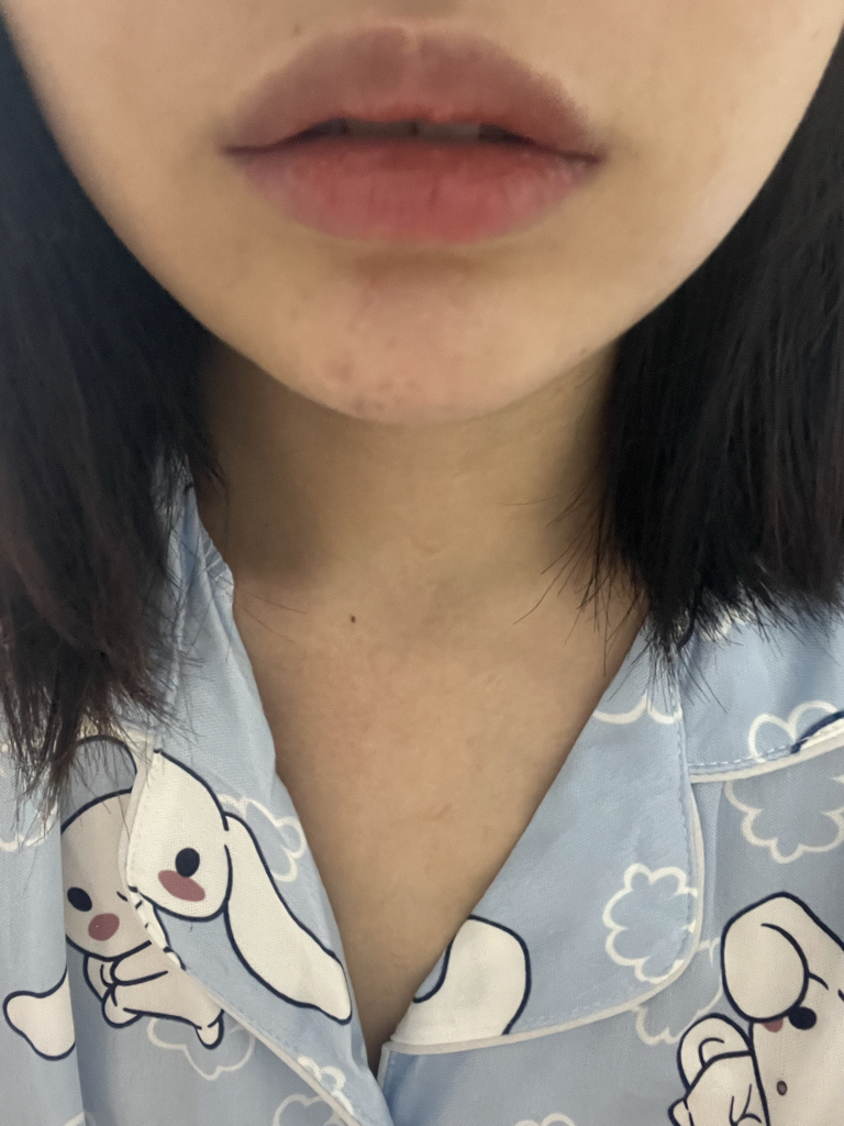 입술 발색