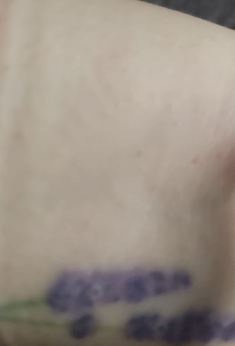 착색