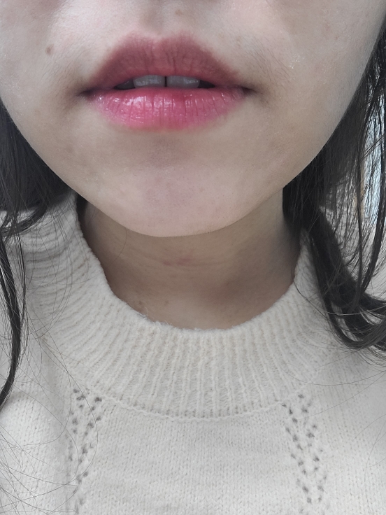 입술 발색
