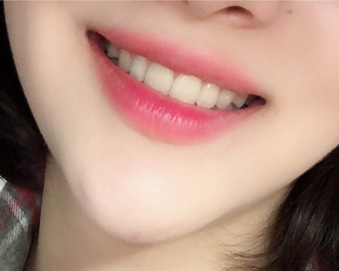착색