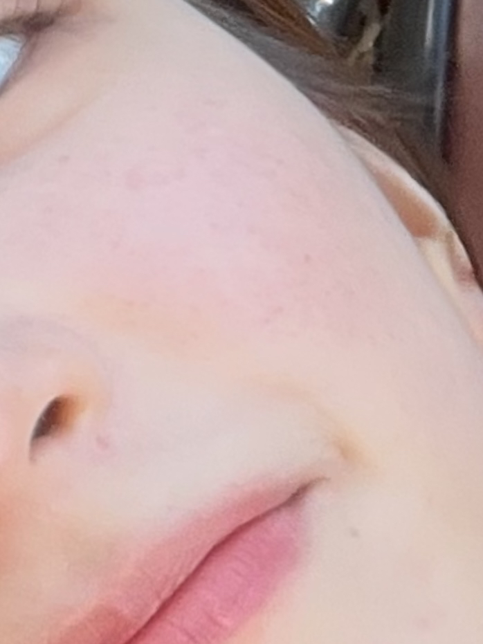 볼 발색