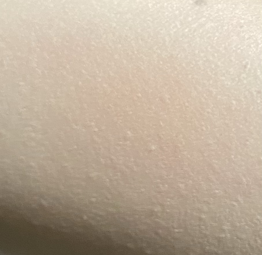볼 발색