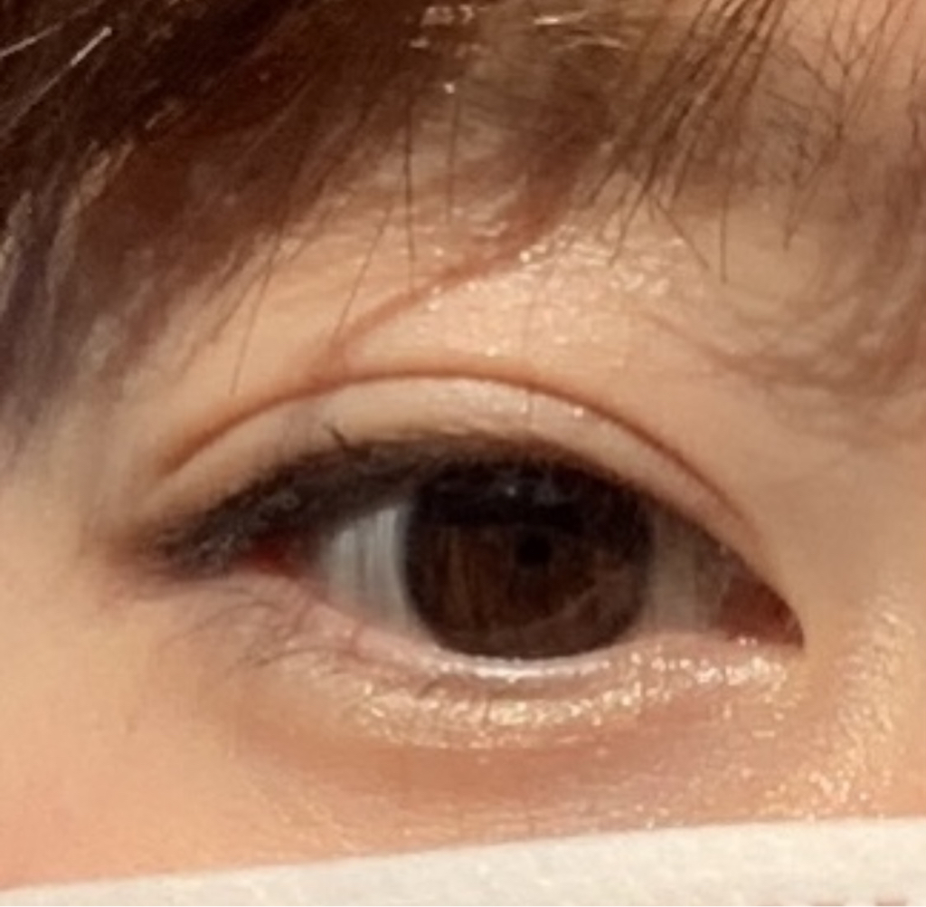눈 발색