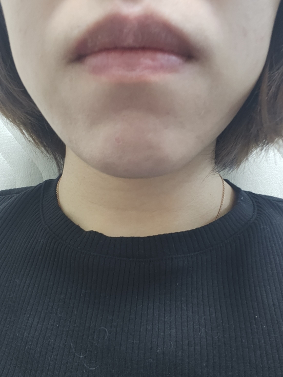 입술 발색