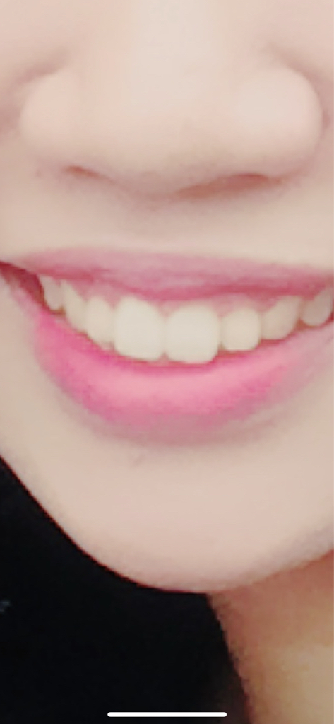 입술 발색