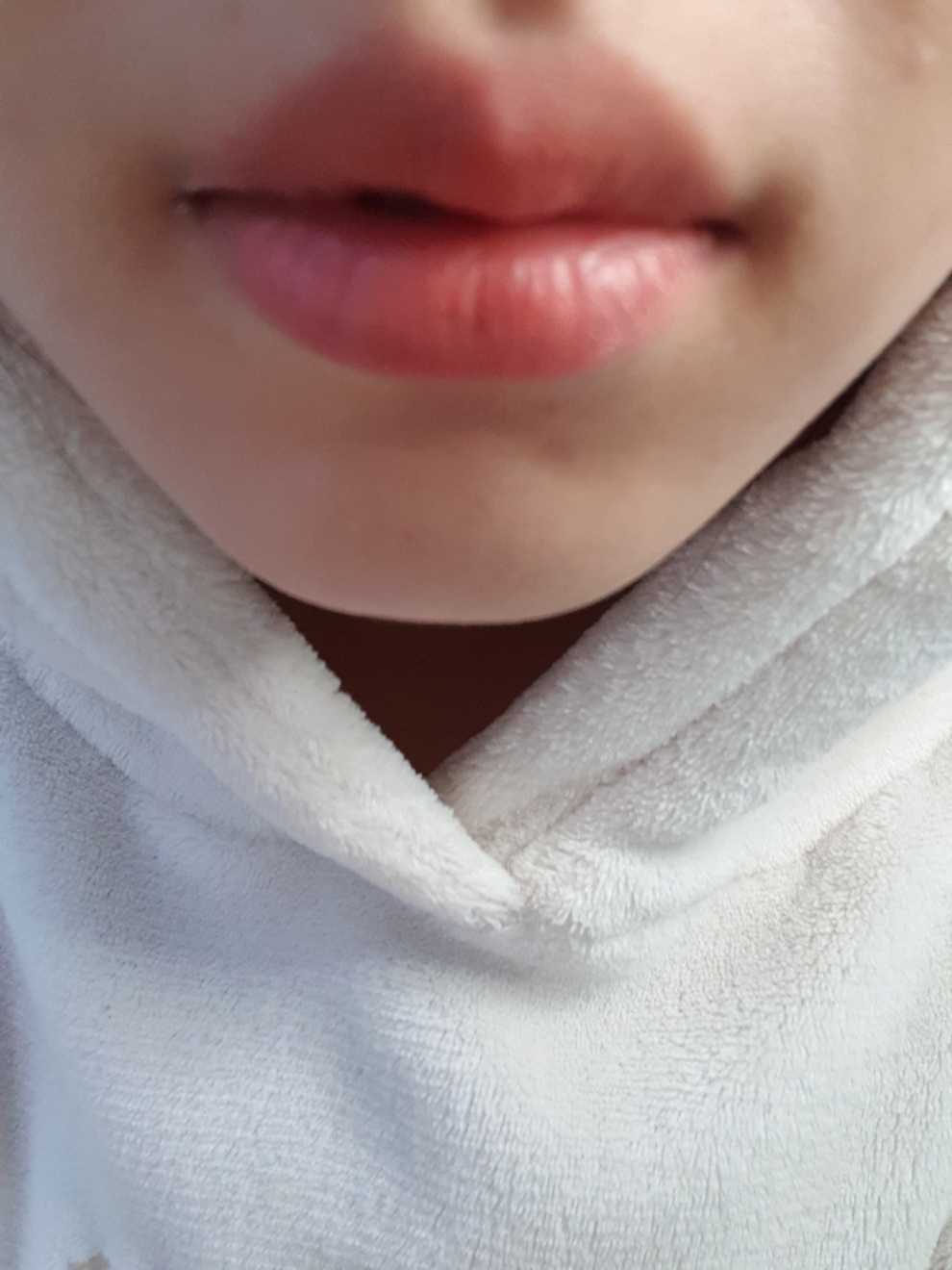 입술 발색