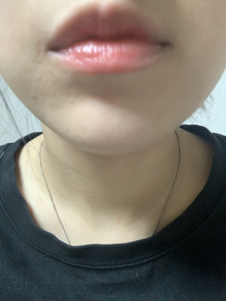 입술 발색