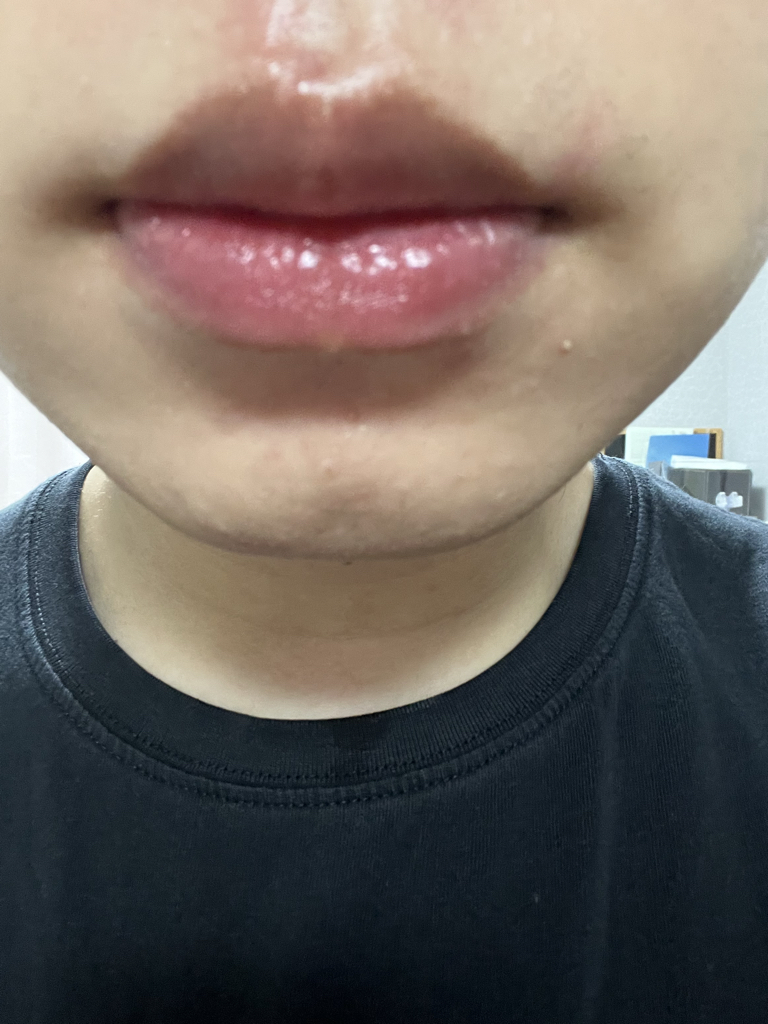 입술 발색