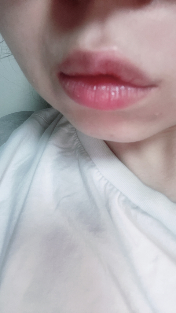 입술 발색