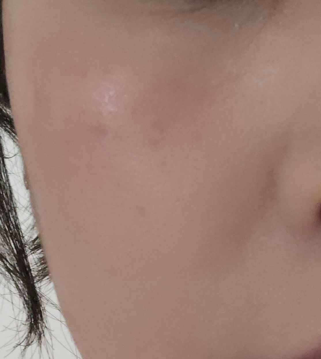 볼 발색