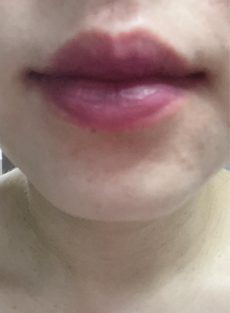입술 발색