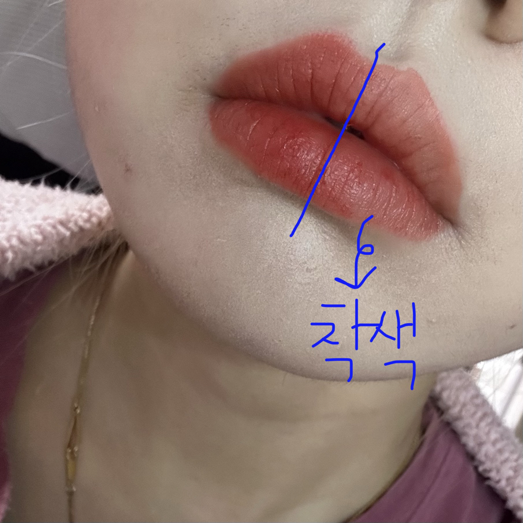 착색