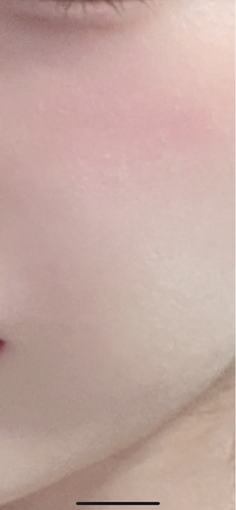 볼 발색