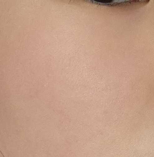 볼 발색