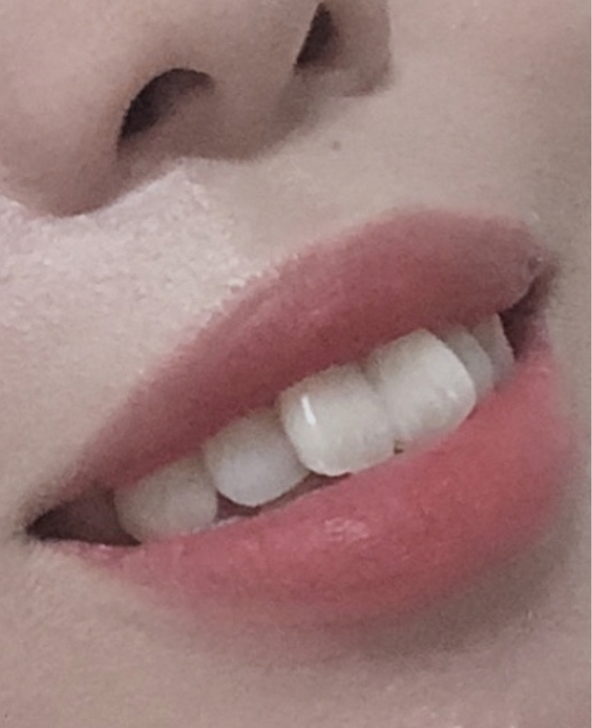 입술 발색