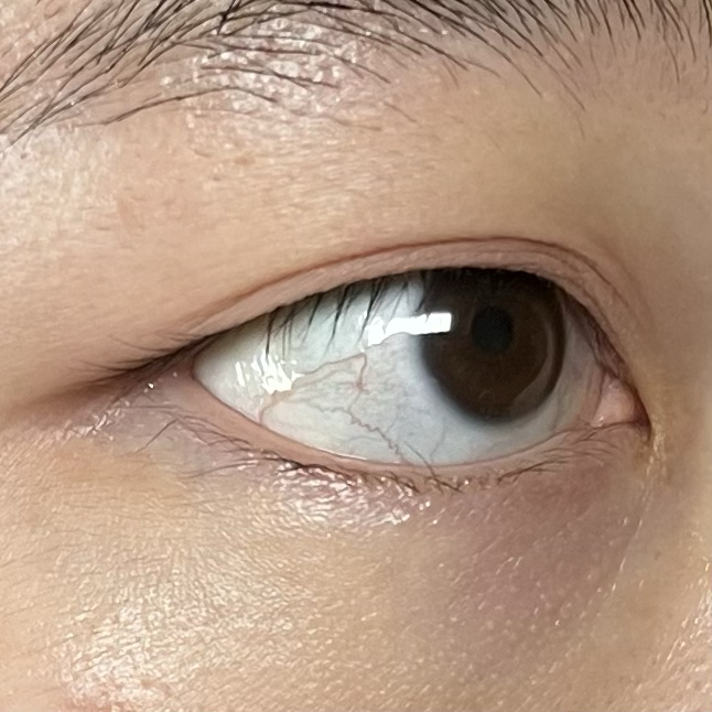 눈 발색