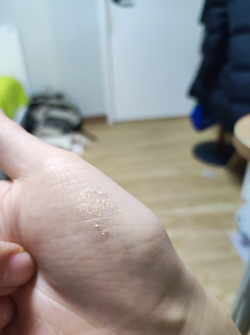 펄감