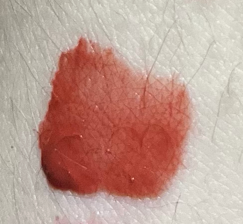 팔목 발색