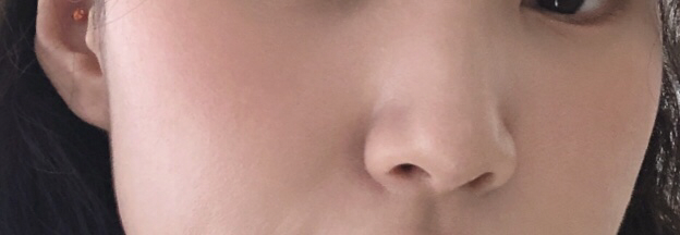 볼 발색