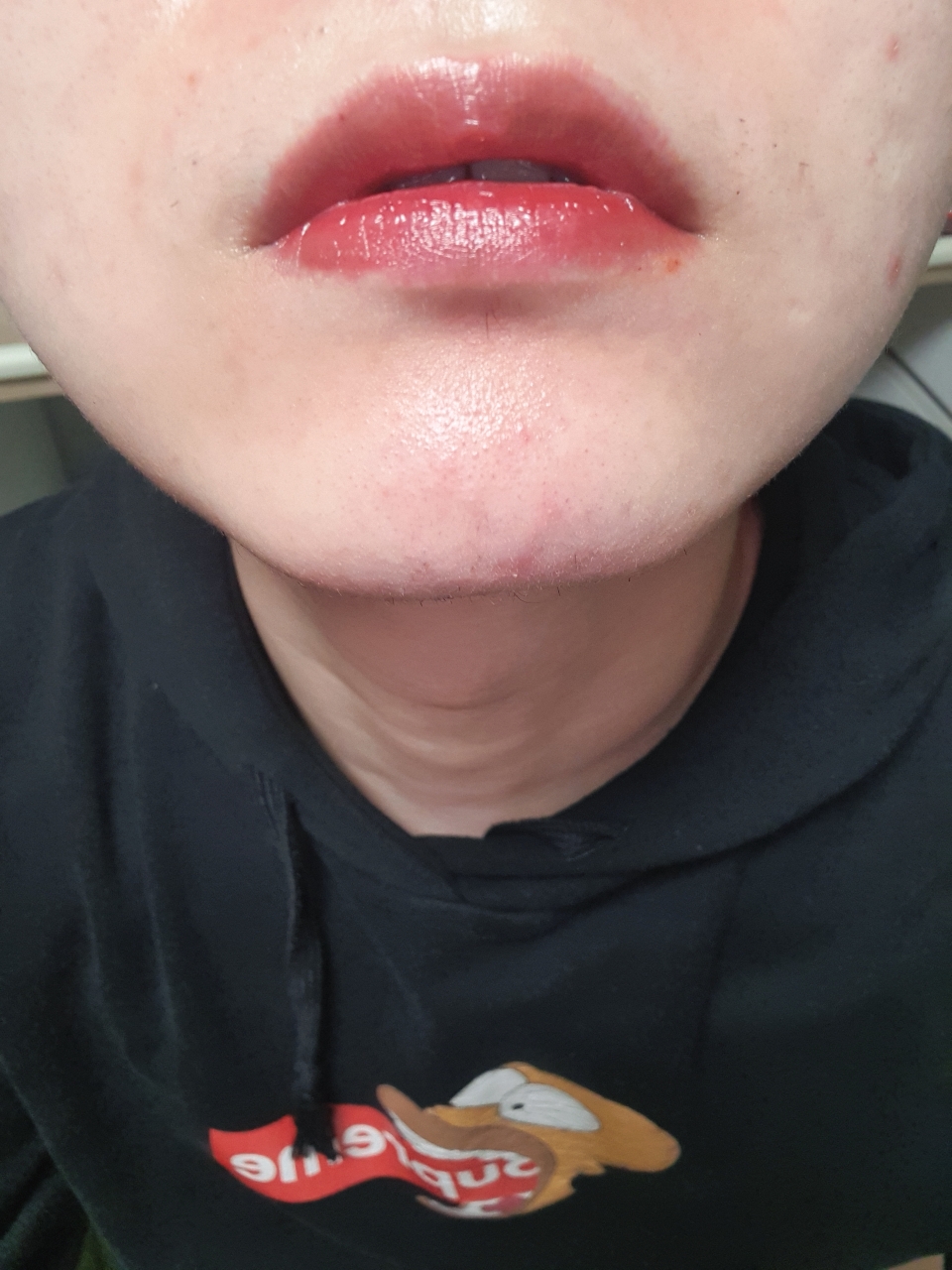 입술 발색