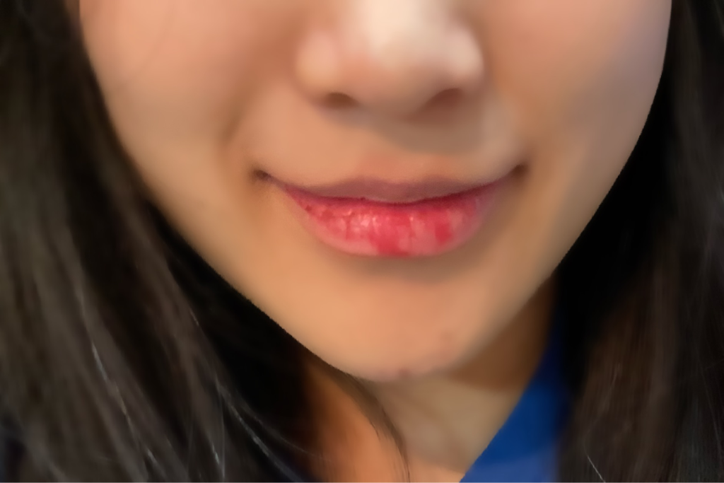착색