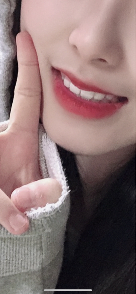 팔목 발색