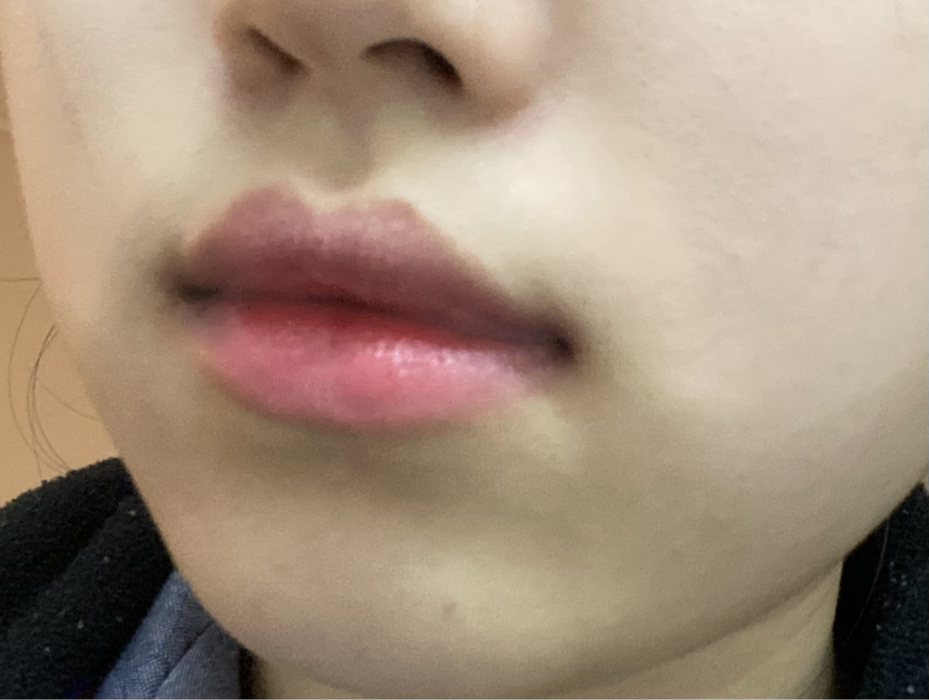입술 발색