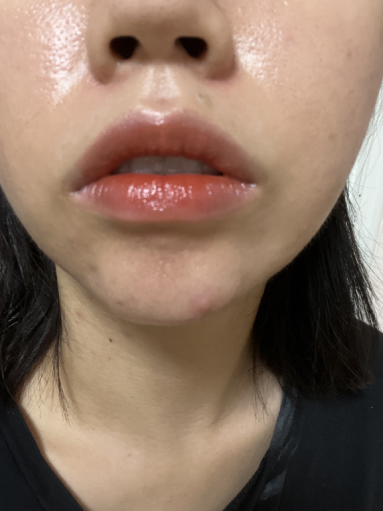 입술 발색