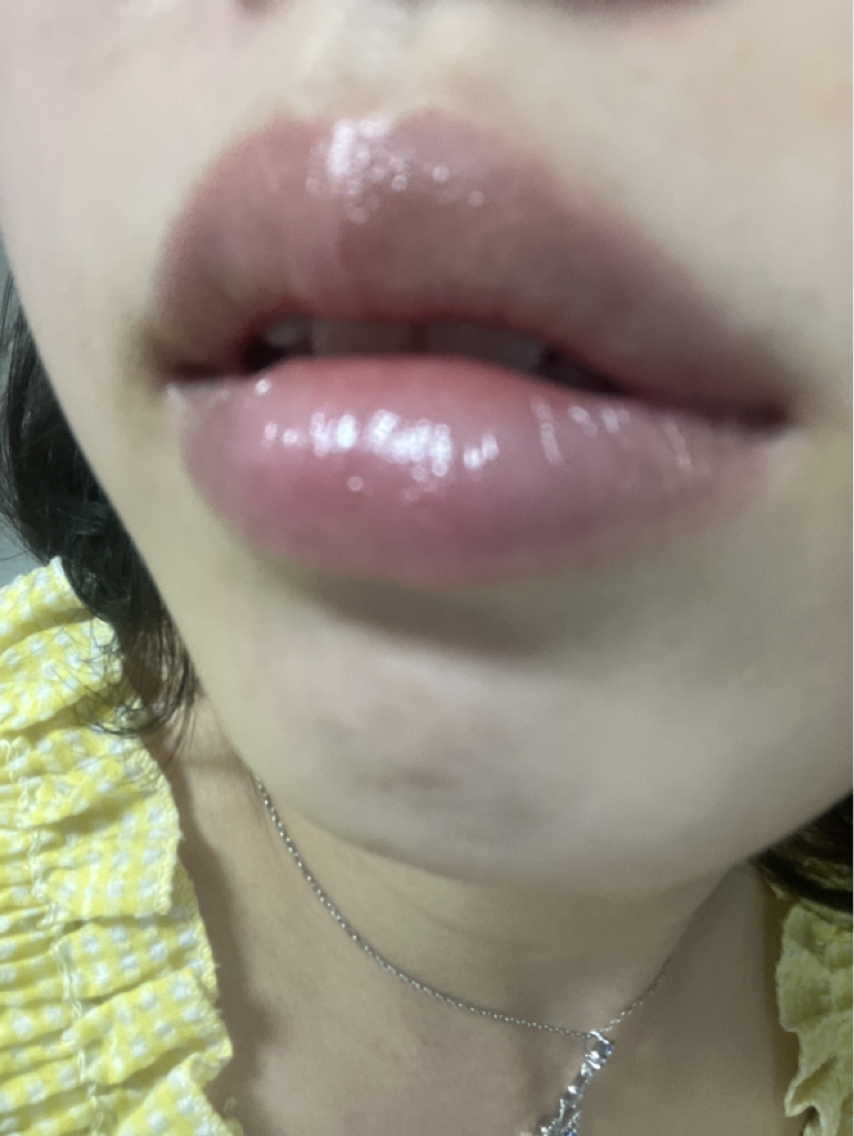 입술 발색