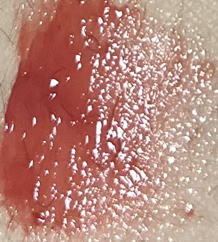 팔목 발색