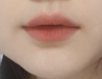 착색