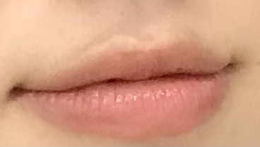 착색
