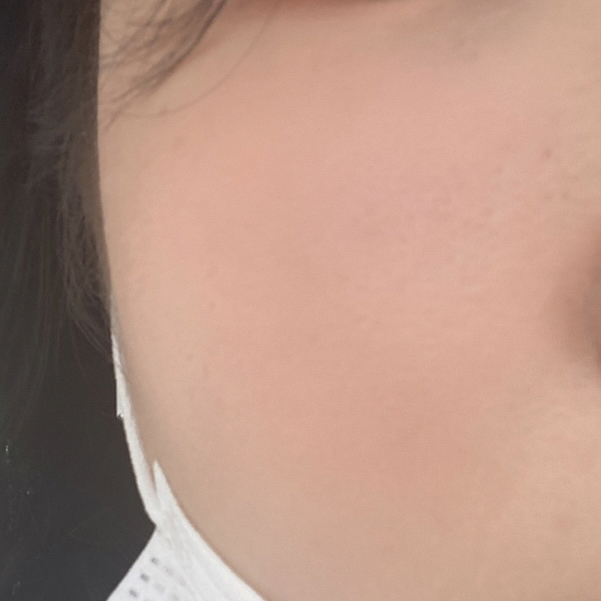 볼 발색