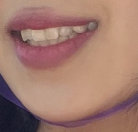 입술 발색