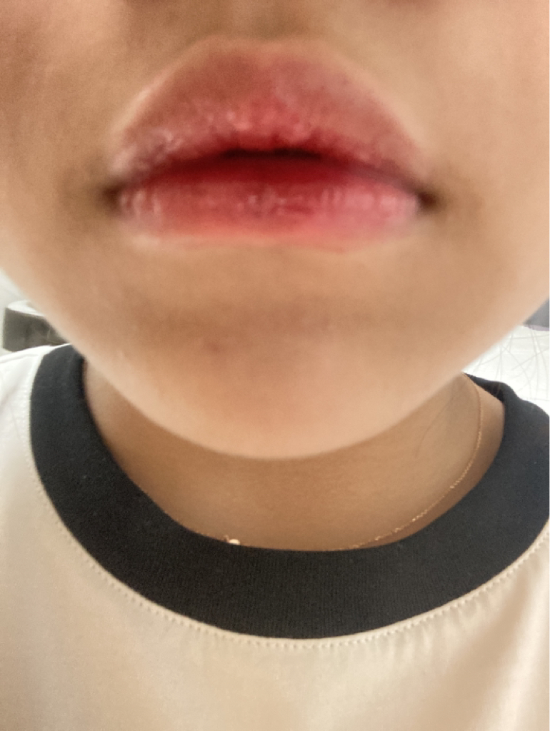 입술 발색