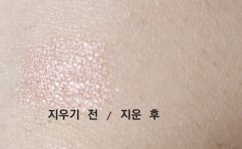 착색