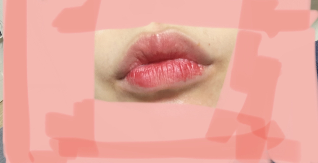 입술 발색