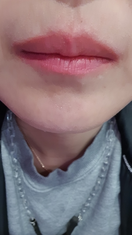 입술 발색