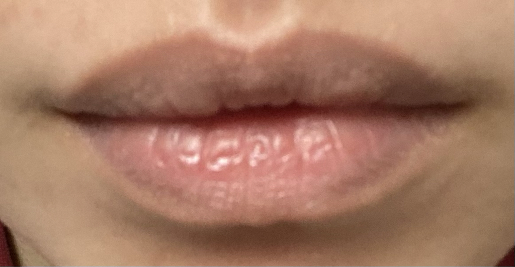 착색