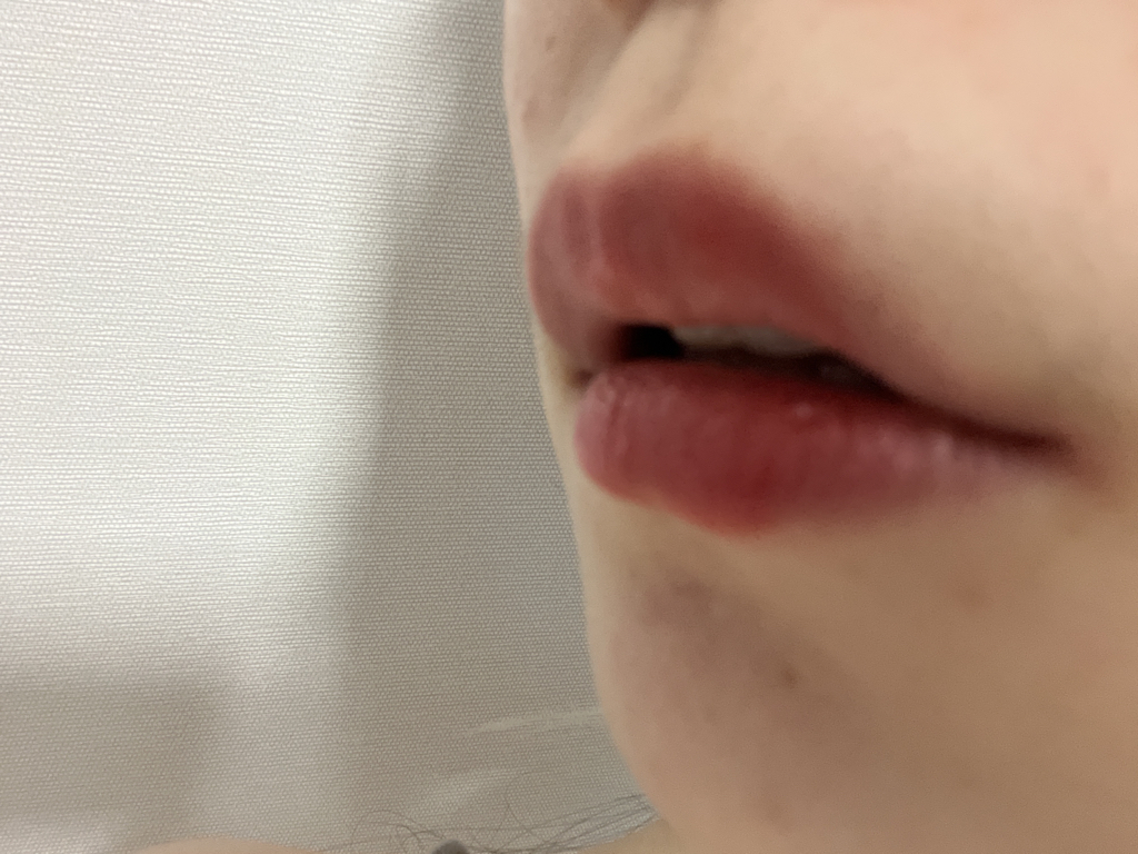 입술 발색