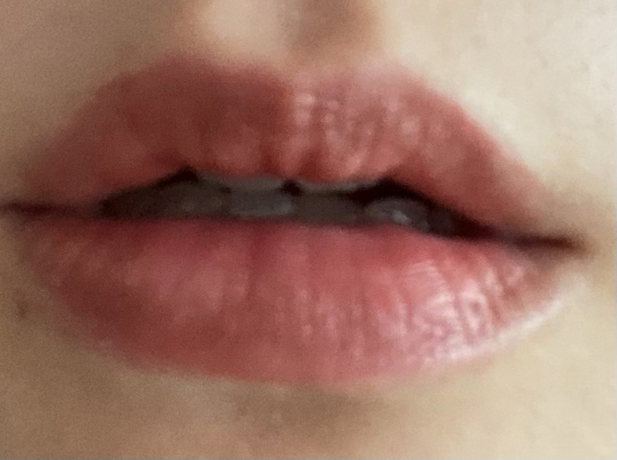 팔목 발색