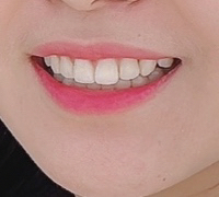 입술 발색
