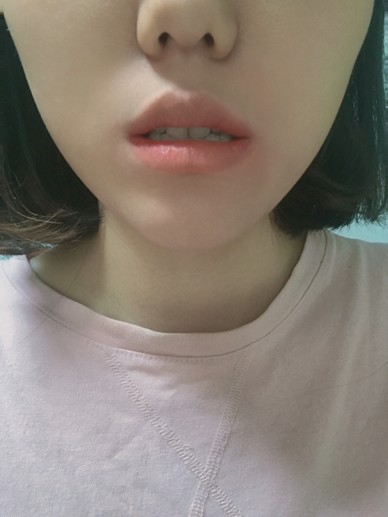 착색